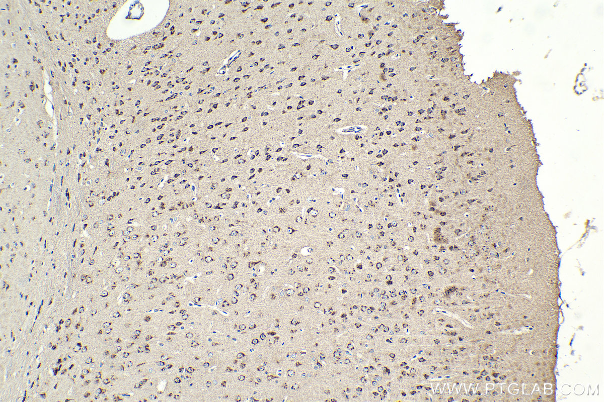 IHC staining of mouse brain using 10738-1-AP