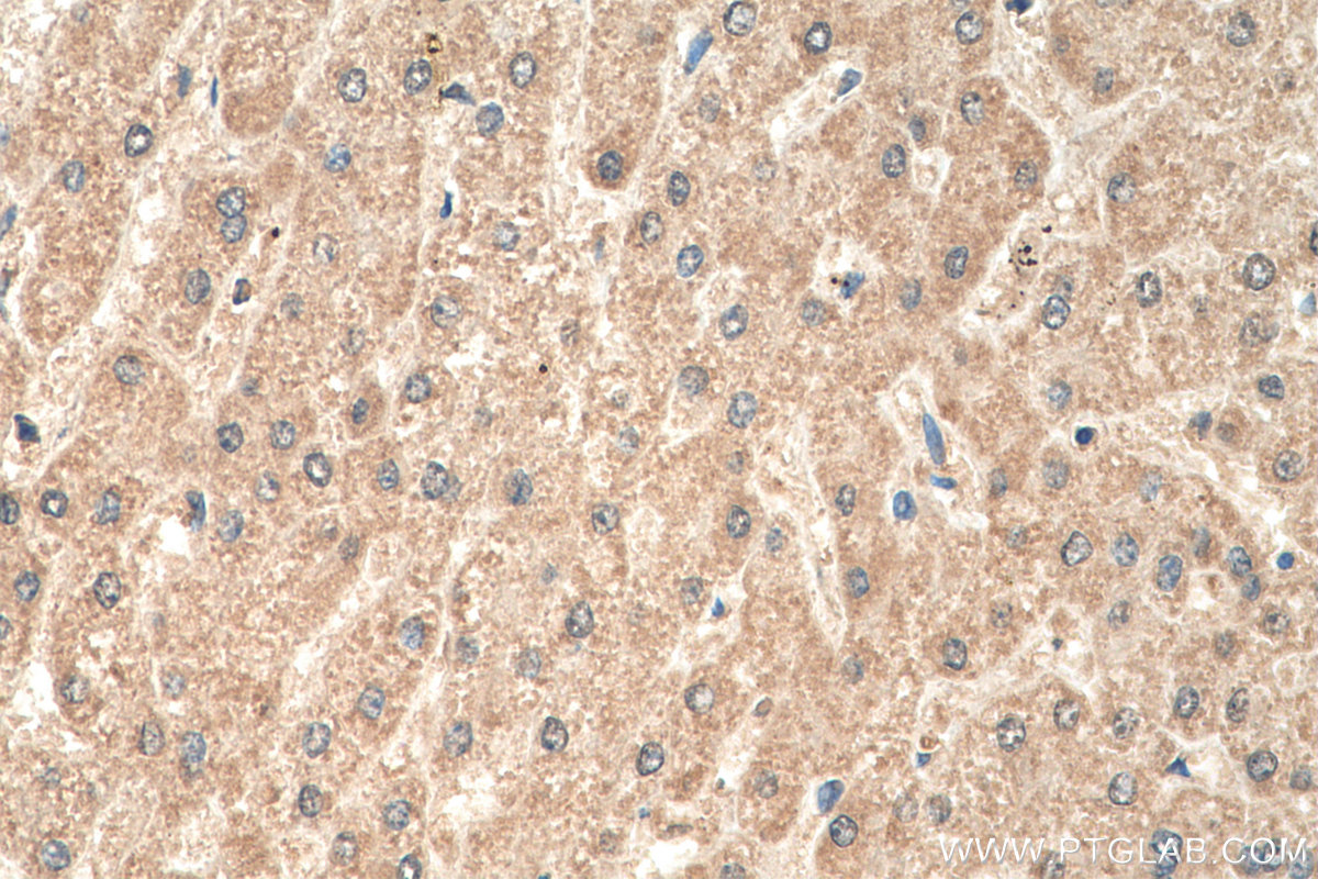 IHC staining of human liver using 22268-1-AP