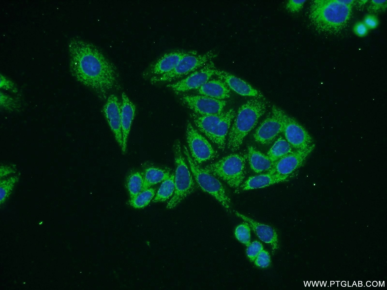 IF Staining of HepG2 using 21492-1-AP