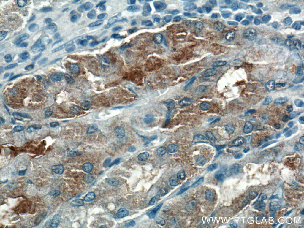 IHC staining of human stomach using 21492-1-AP