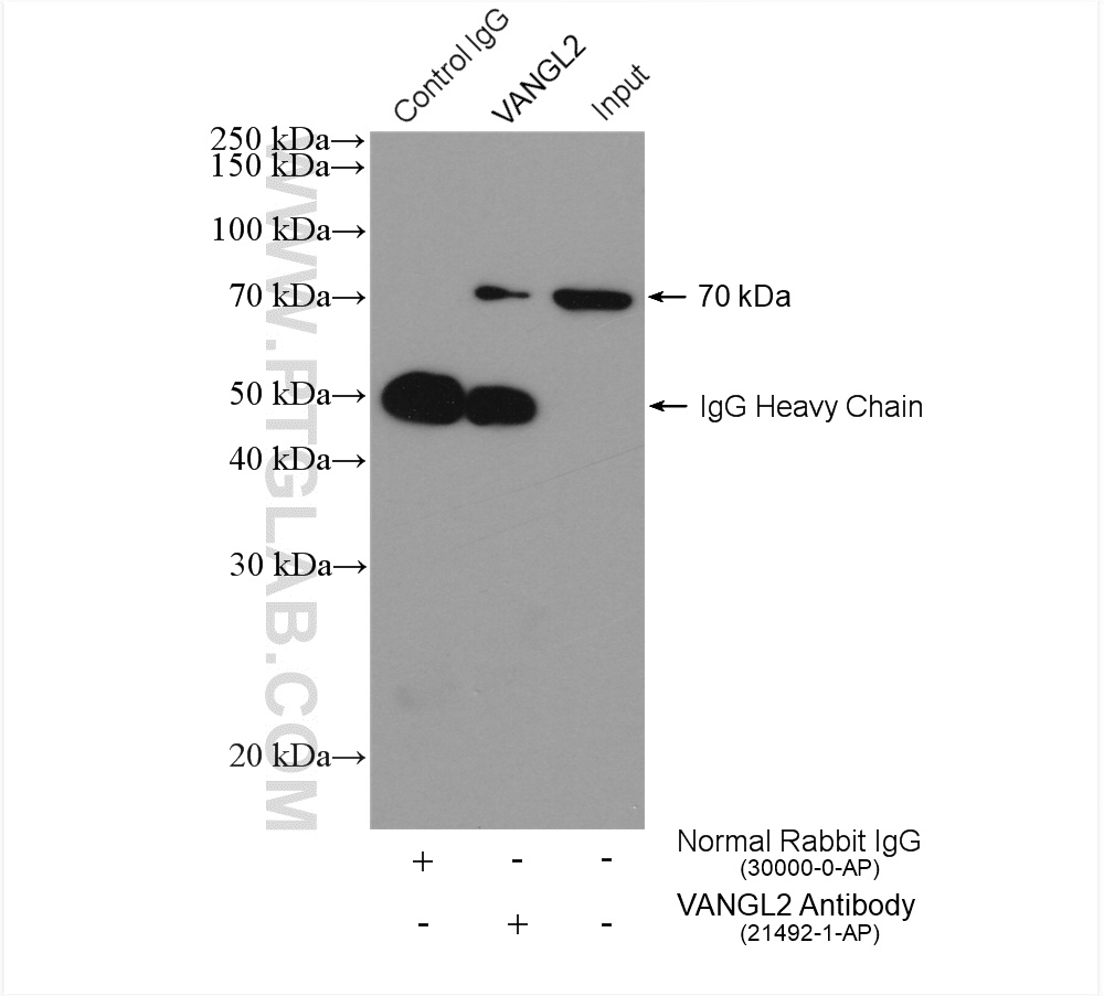 IP experiment of HepG2 using 21492-1-AP