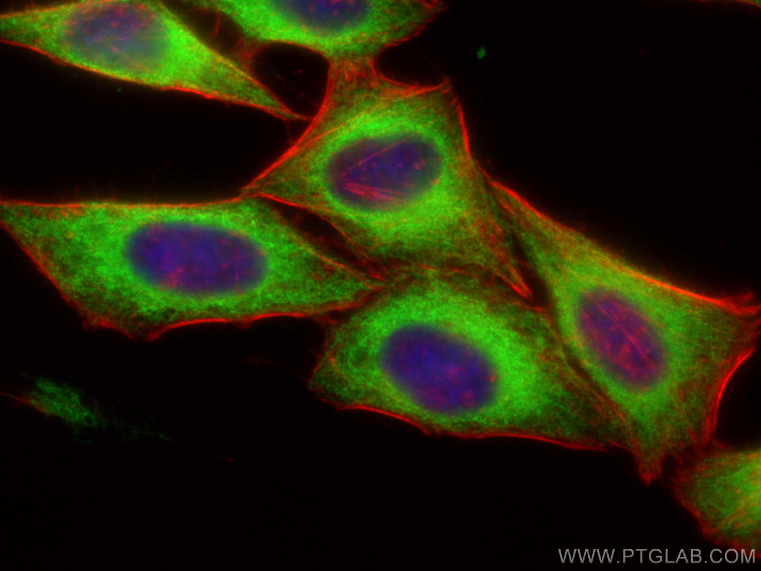 IF Staining of HepG2 using 15275-1-AP