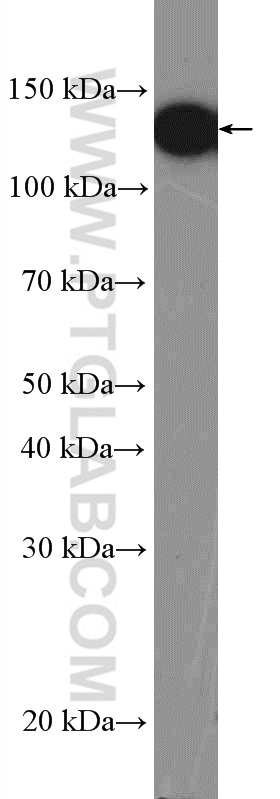 WB analysis of HL-60 using 15931-1-AP