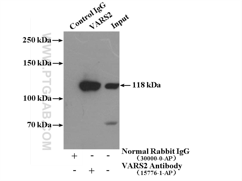 IP experiment of HeLa using 15776-1-AP