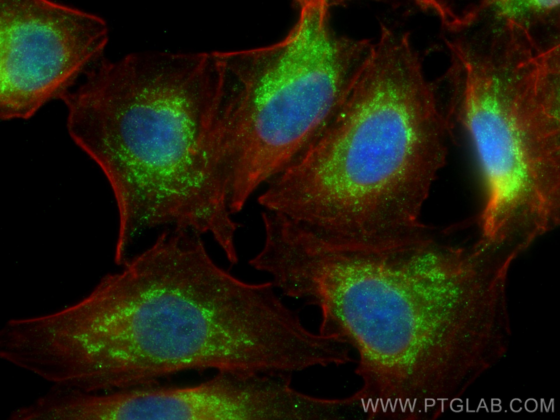 IF Staining of A549 using 13303-1-AP