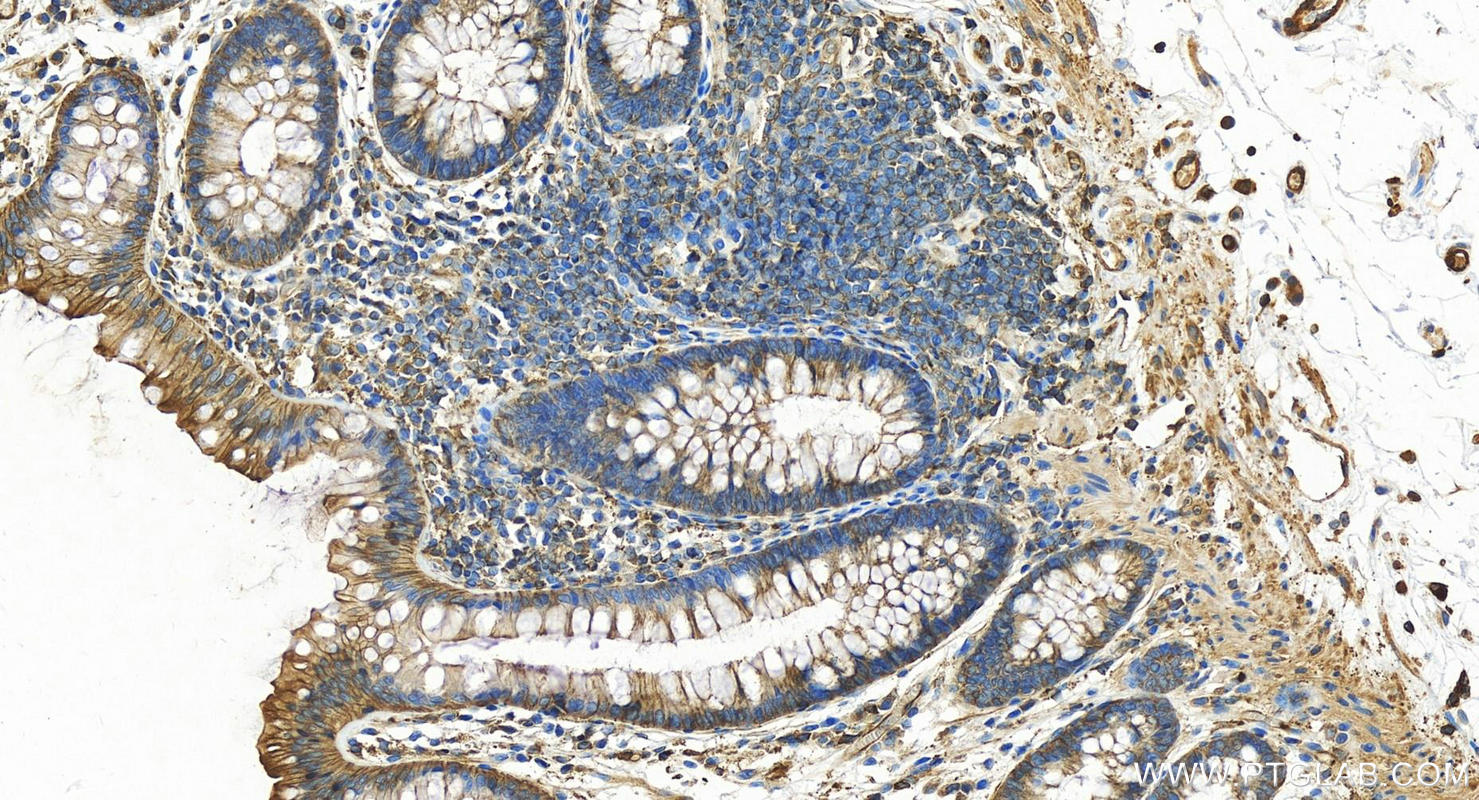 IHC staining of human normal colon using 13472-1-AP