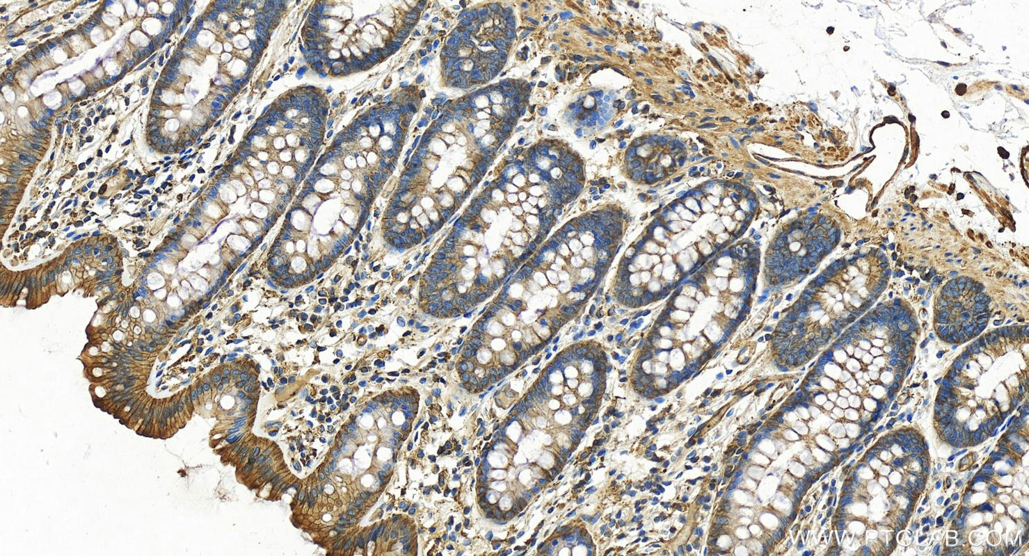 IHC staining of human normal colon using 13472-1-AP