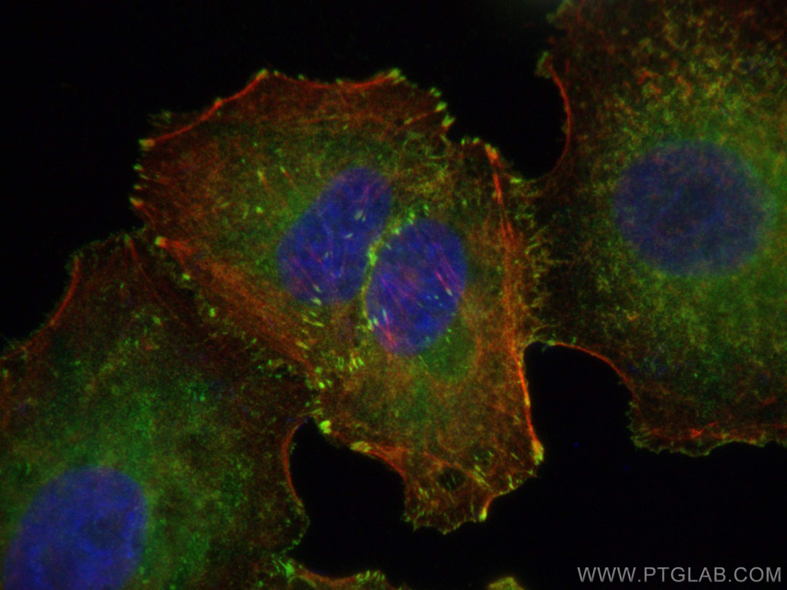 IF Staining of A549 using 13472-1-AP