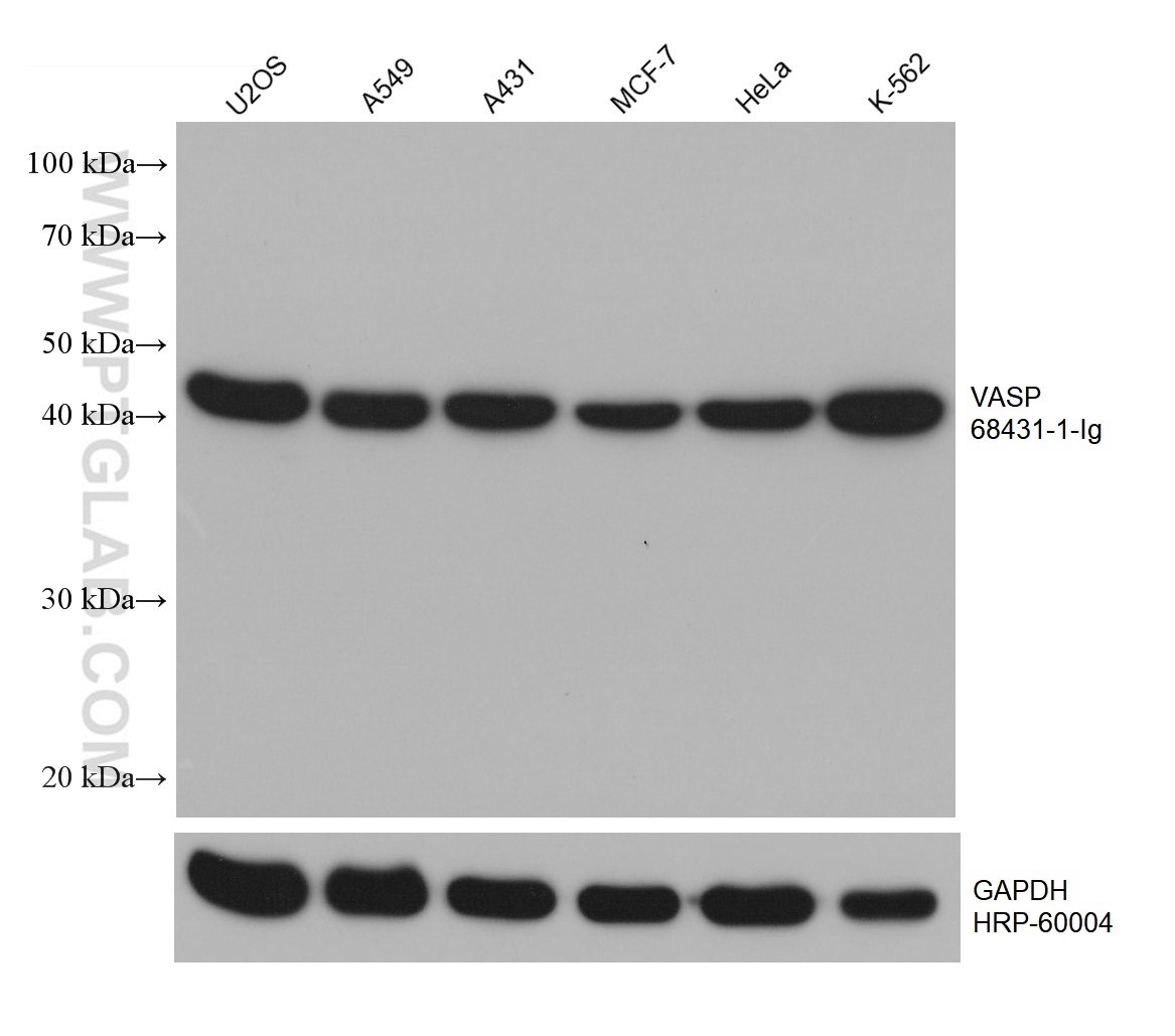 WB analysis using 68431-1-Ig (same clone as 68431-1-PBS)