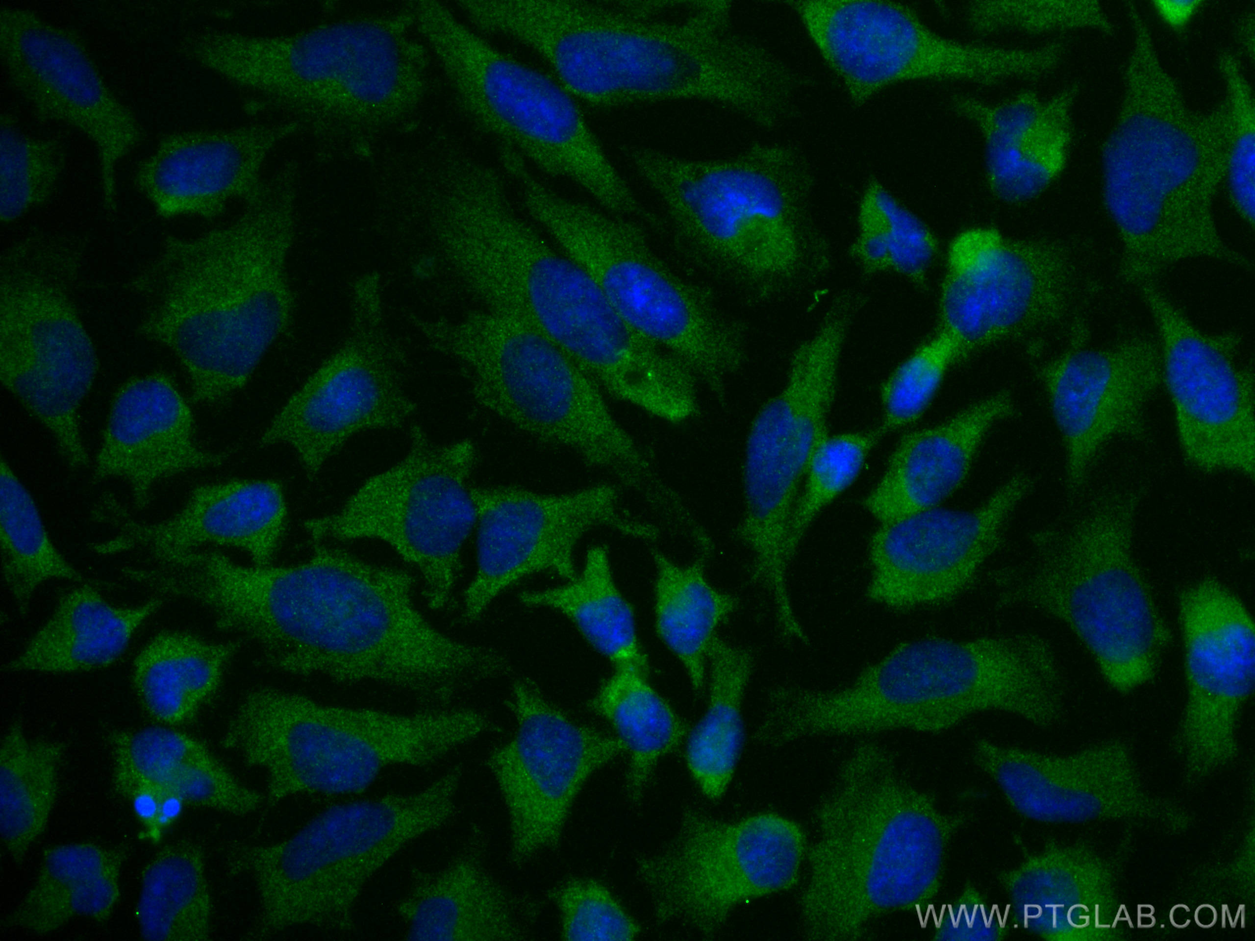 IF Staining of HeLa using 21924-1-AP