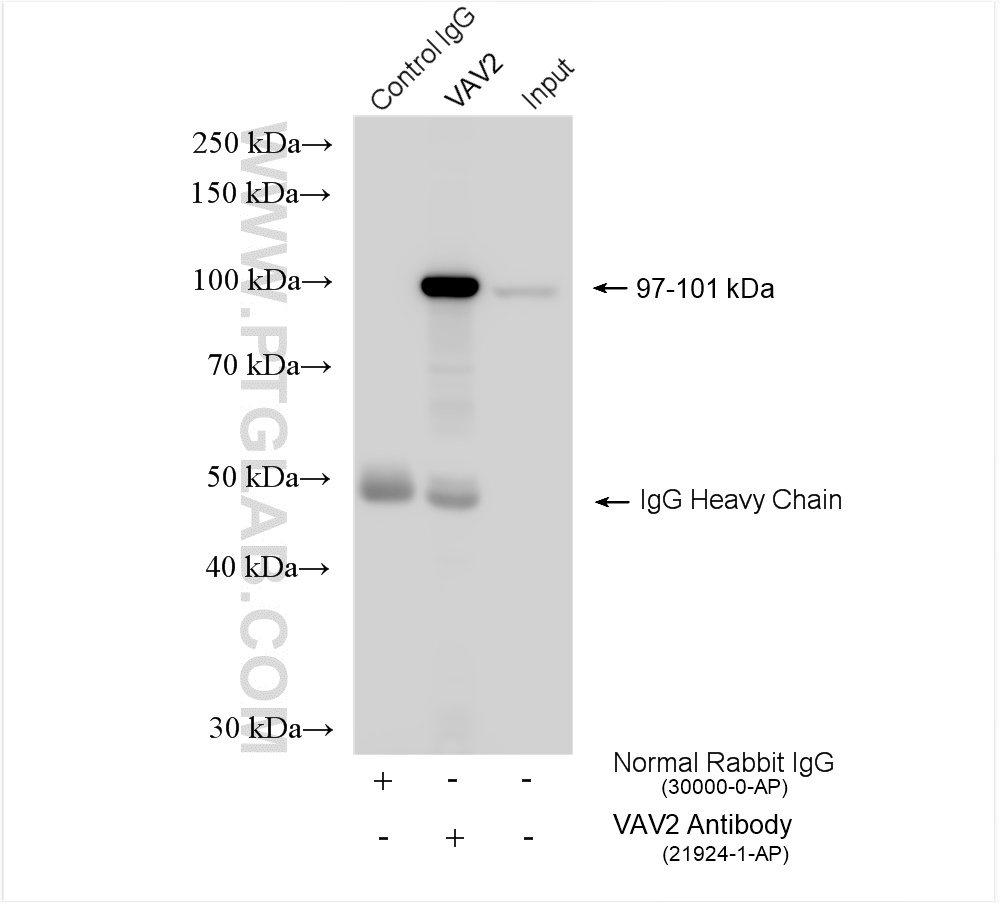 IP experiment of HeLa using 21924-1-AP