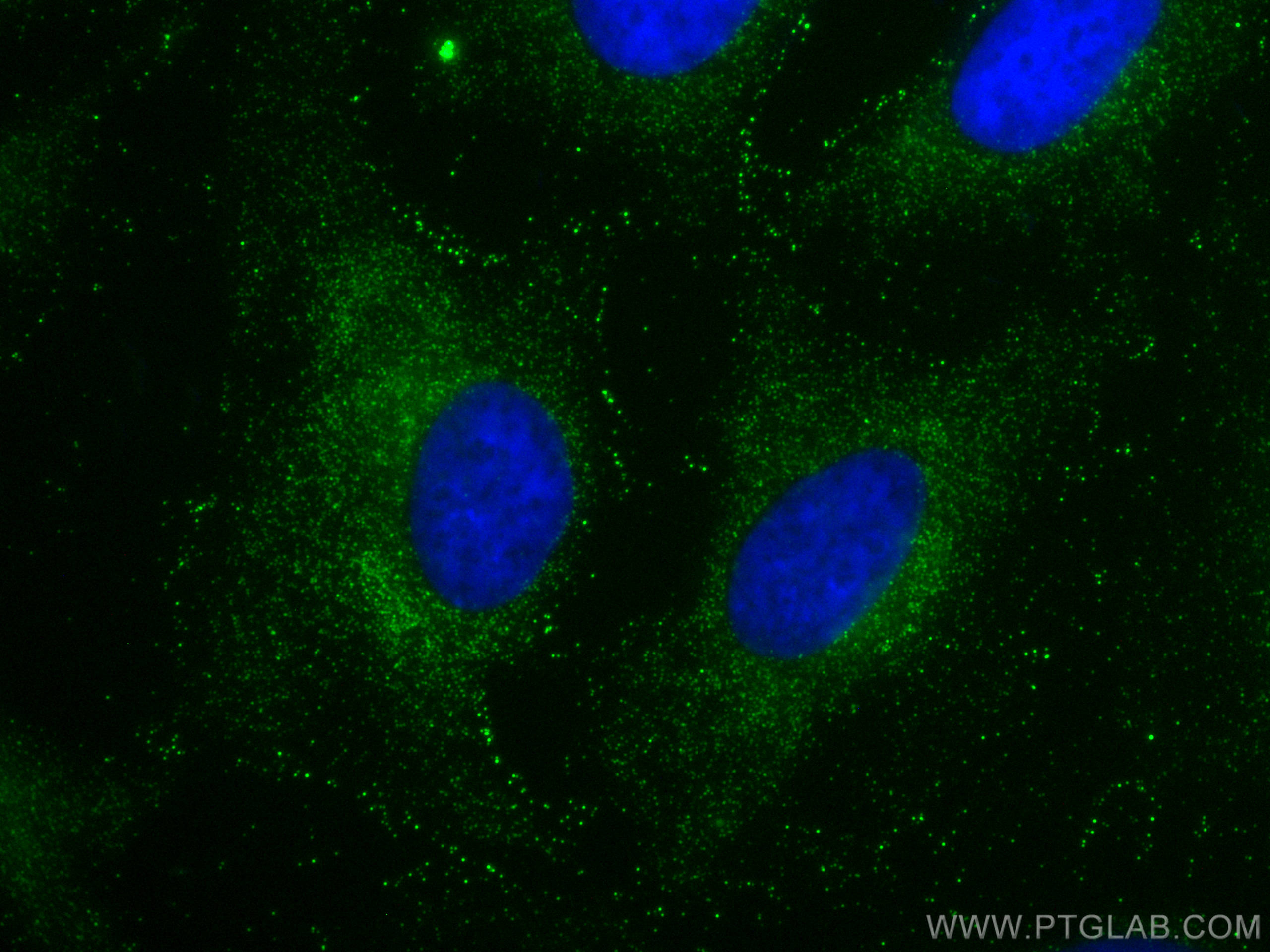 IF Staining of HeLa using 30291-1-AP