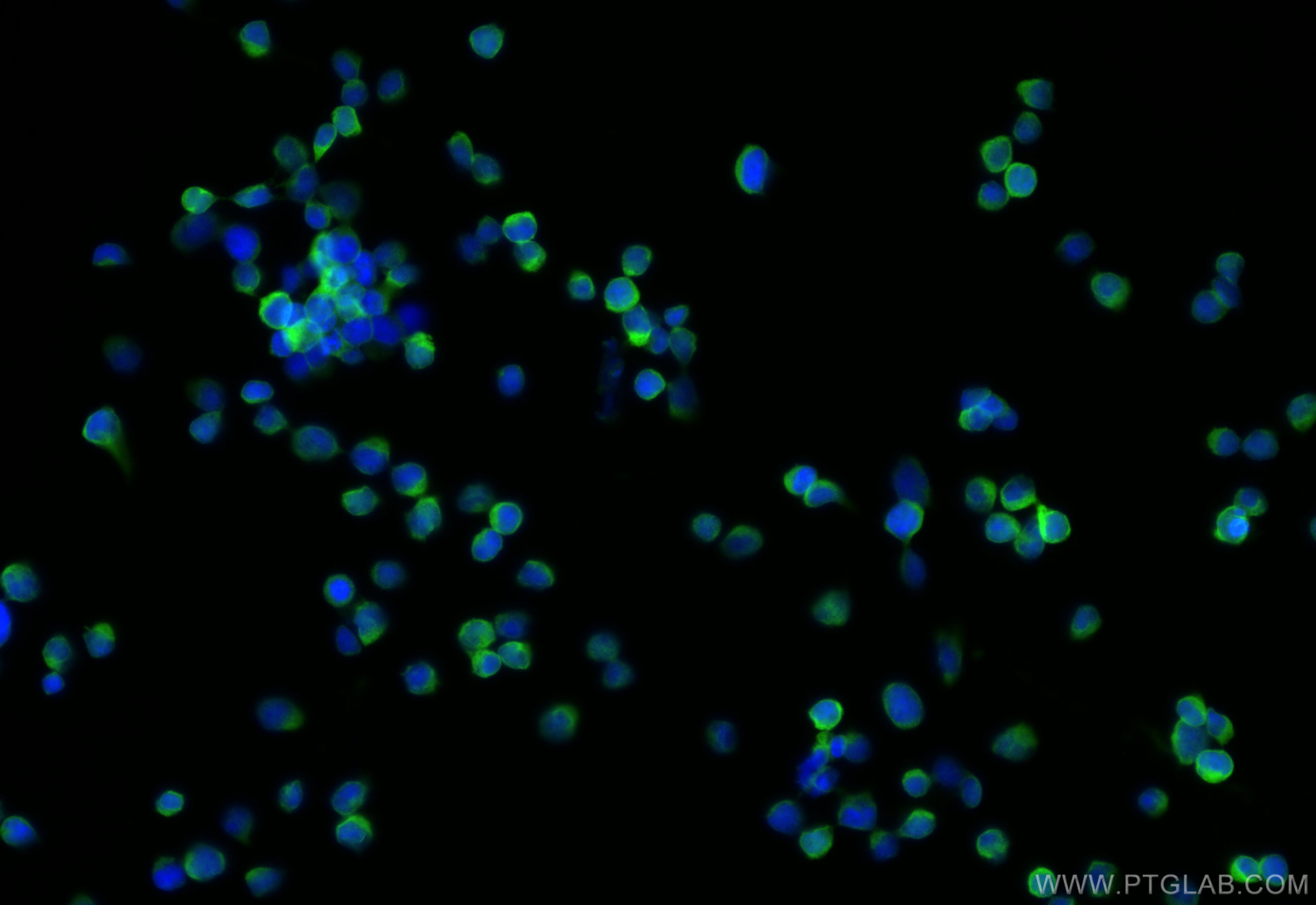 IF Staining of Jurkat using 30291-1-AP