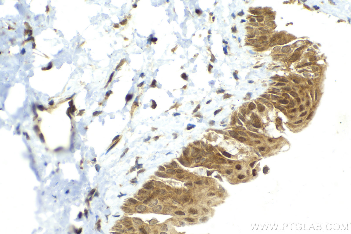 IHC staining of rat eye using 15773-1-AP