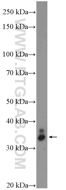 WB analysis of mouse eye using 15773-1-AP