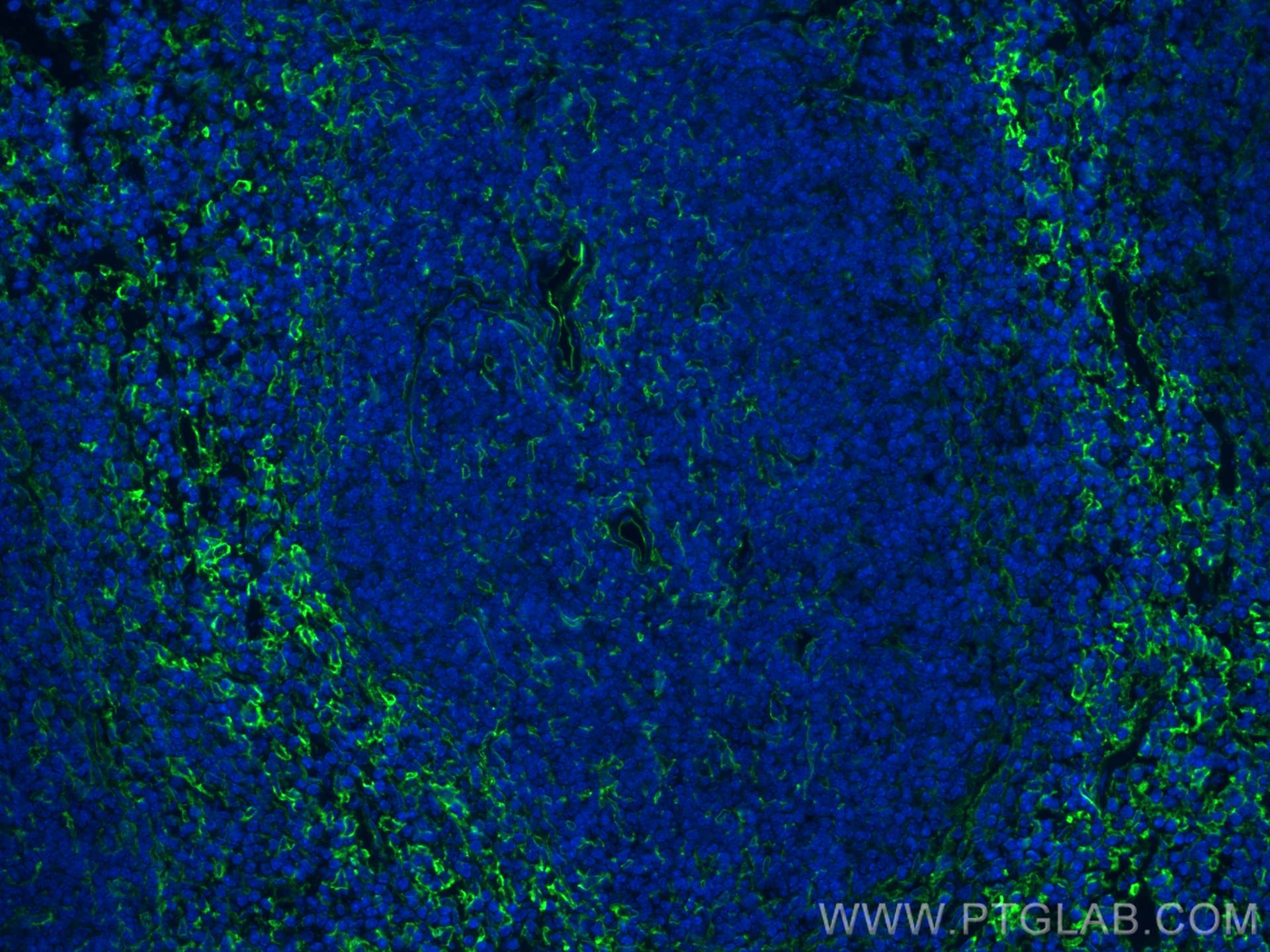 IF Staining of mouse spleen using 30958-1-AP