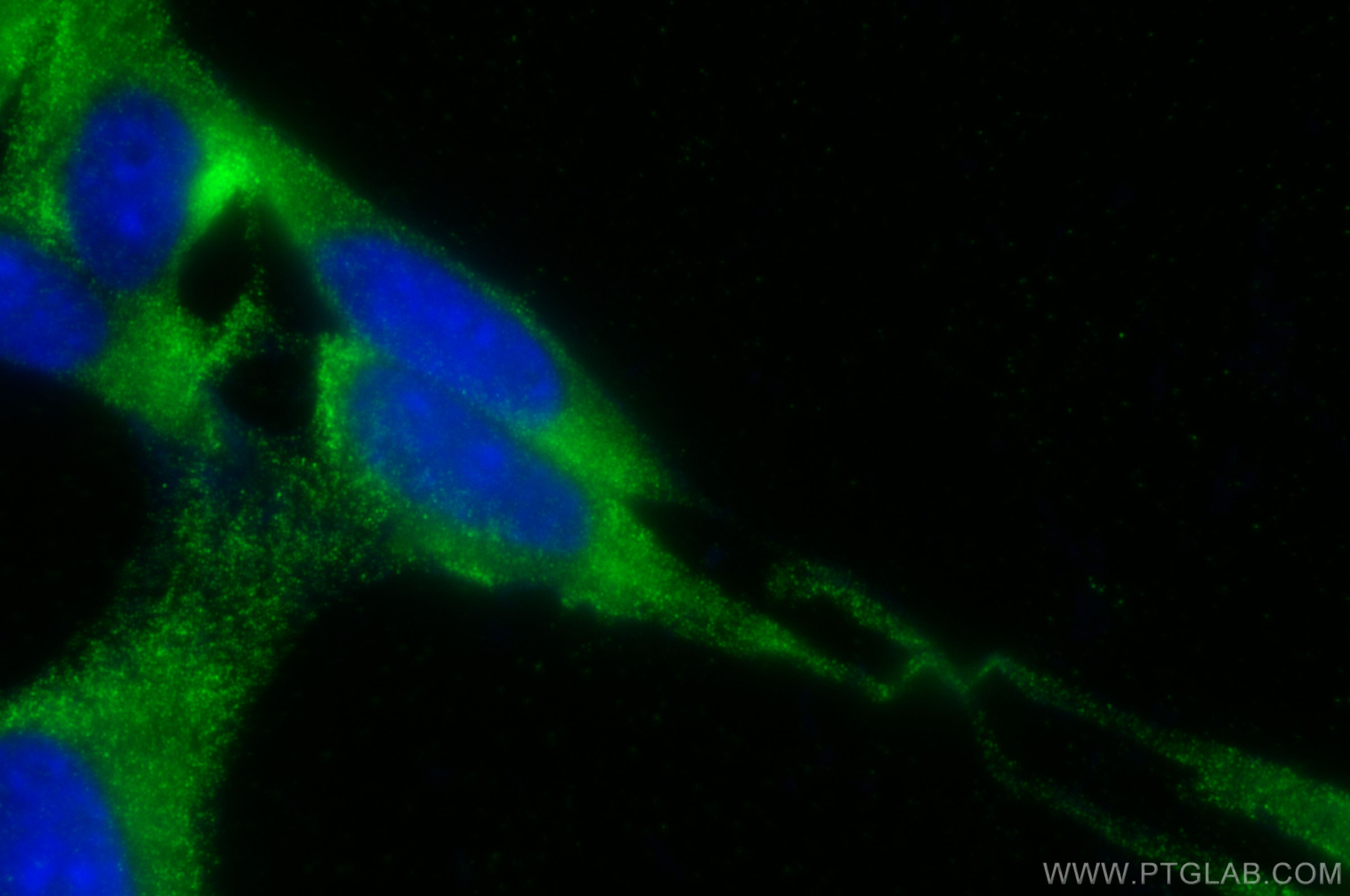 IF Staining of NIH/3T3 using 30599-1-AP