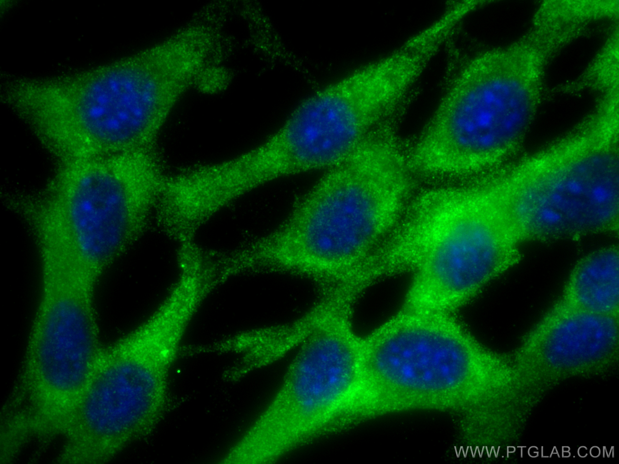 IF Staining of NIH/3T3 using 30599-1-AP (same clone as 30599-1-PBS)