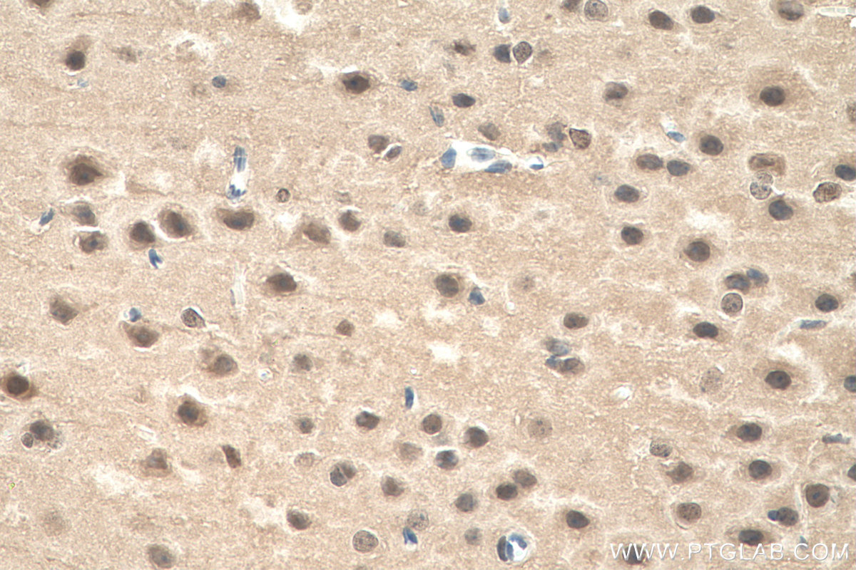 IHC staining of mouse brain using 60316-1-Ig