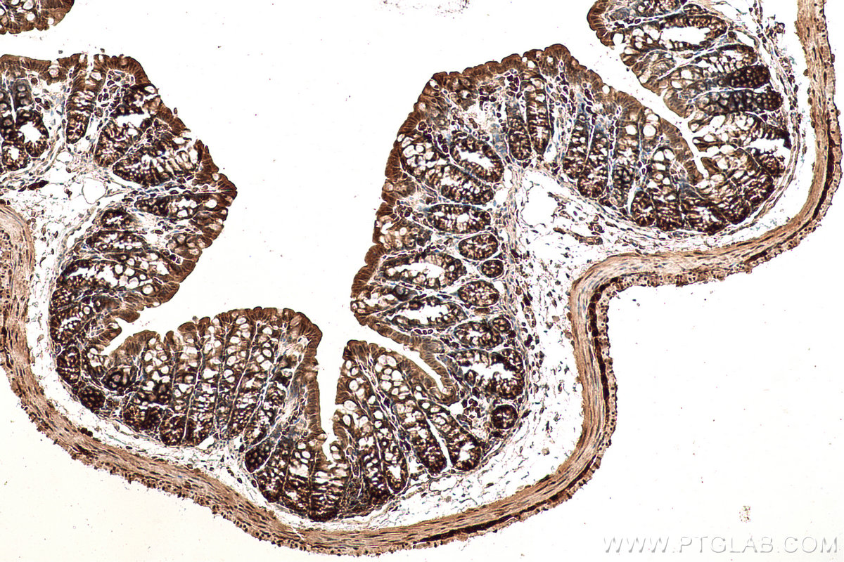 IHC staining of mouse colon using 60316-1-Ig