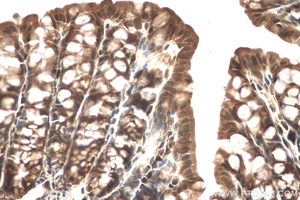 IHC staining of mouse colon using 60316-1-Ig