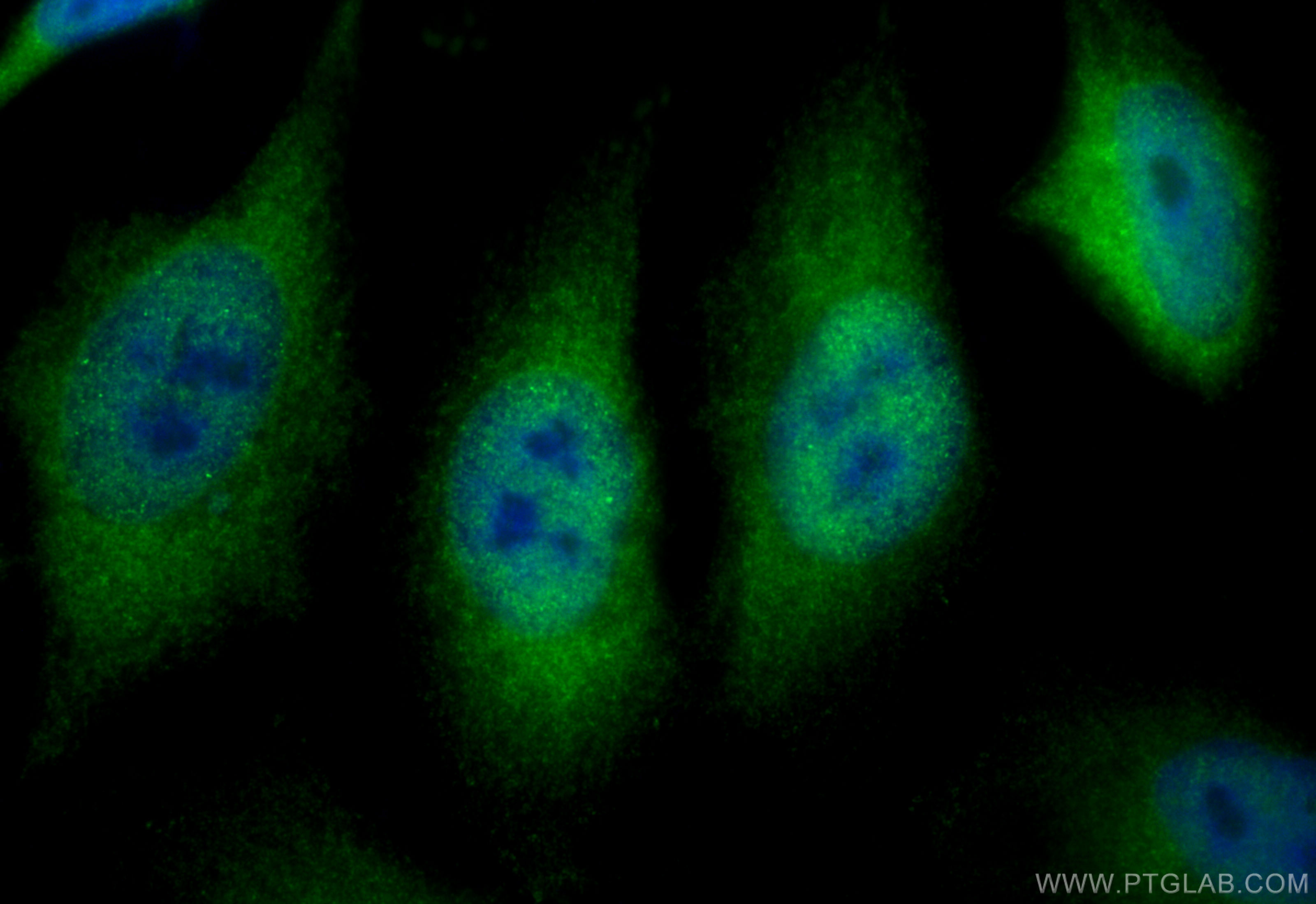 IF Staining of HeLa using 82463-1-RR (same clone as 82463-1-PBS)