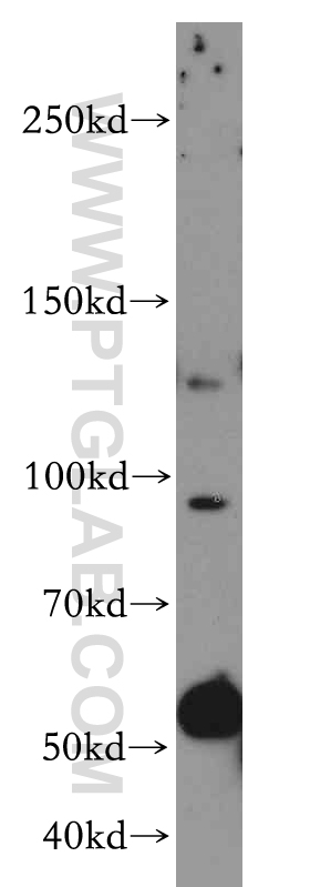 WB analysis of MCF-7 using 17802-1-AP