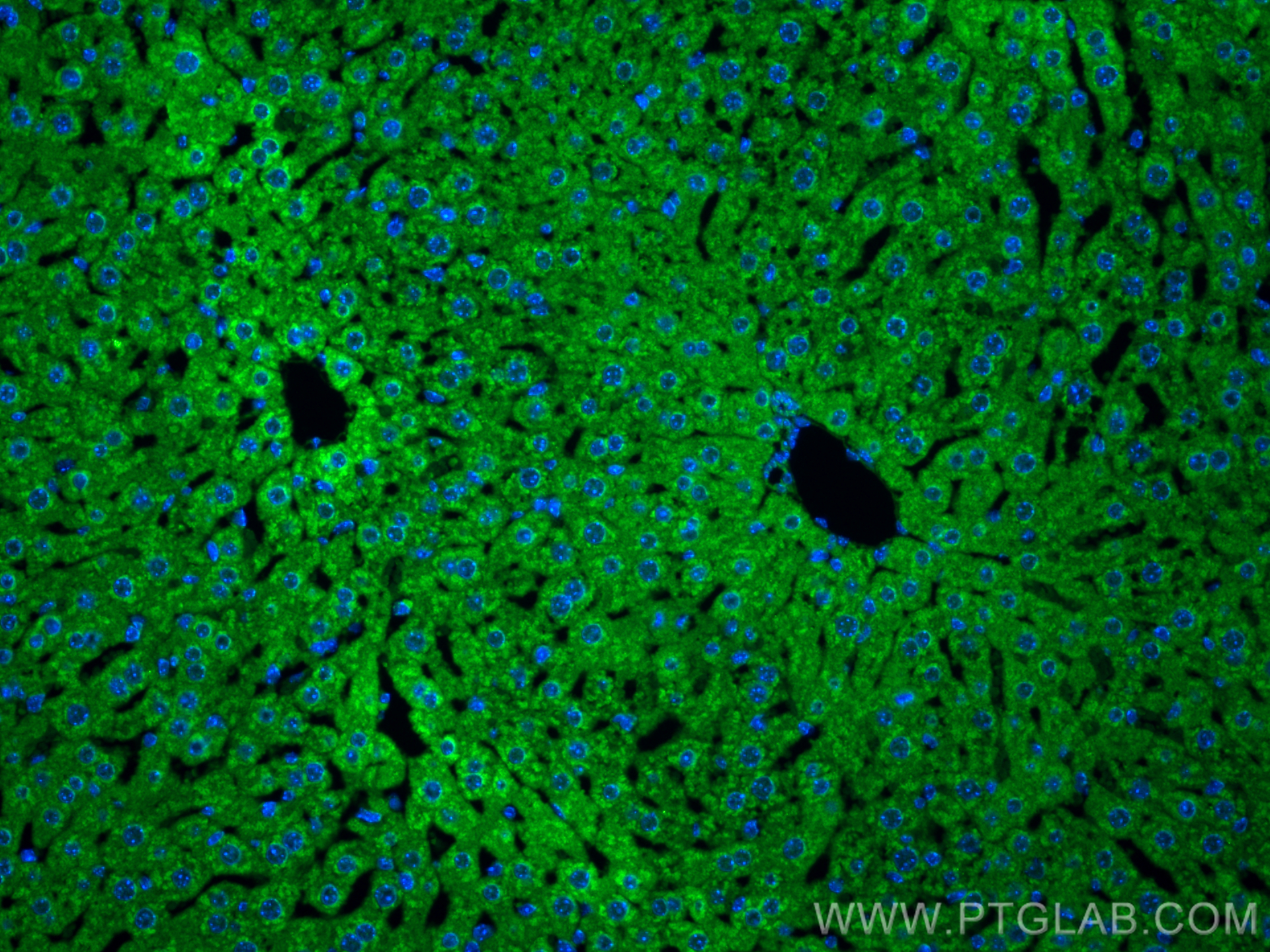 IF Staining of mouse liver using 10866-1-AP