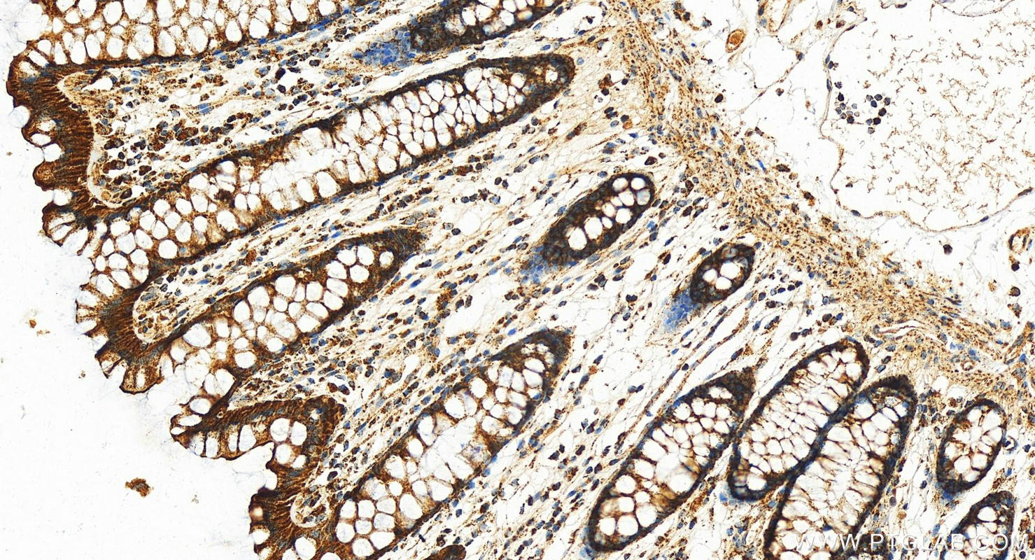 IHC staining of human normal colon using 11663-1-AP