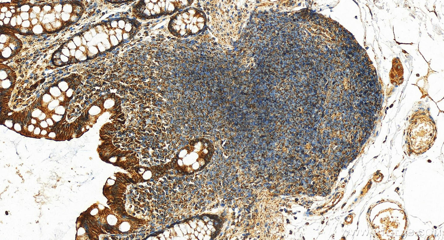 IHC staining of human normal colon using 11663-1-AP