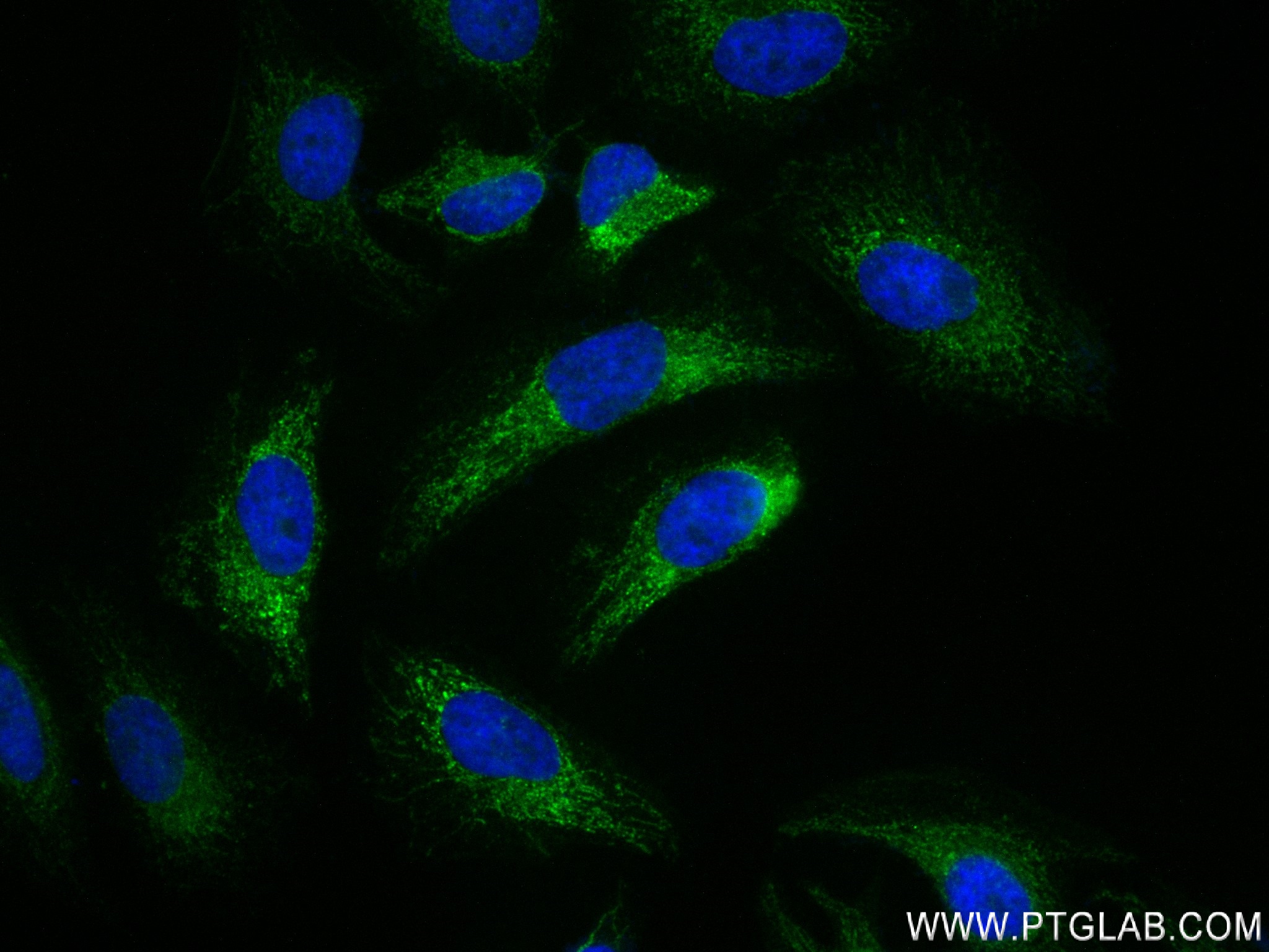 IF Staining of HeLa using 84225-3-RR