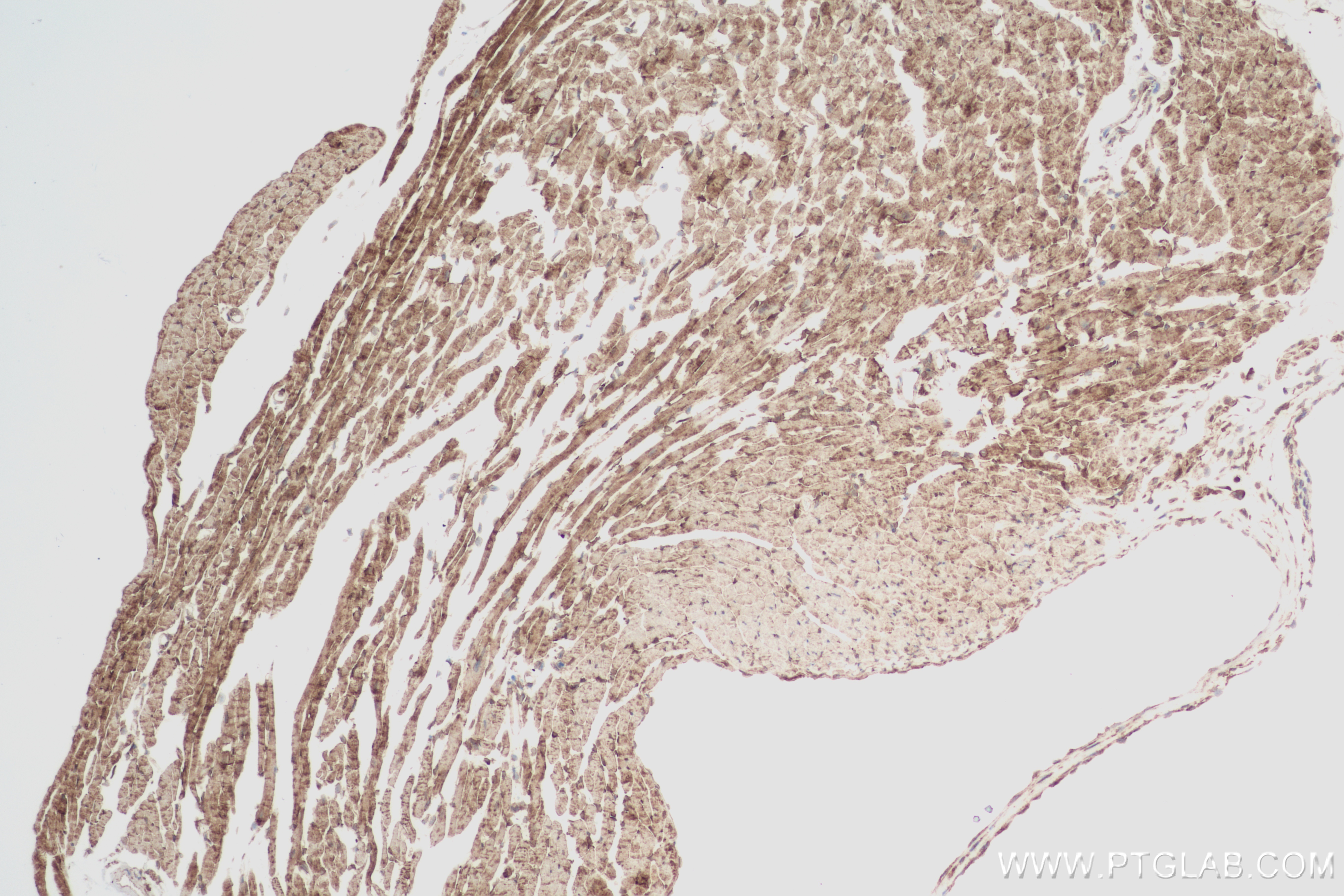 IHC staining of mouse heart using 84225-3-RR