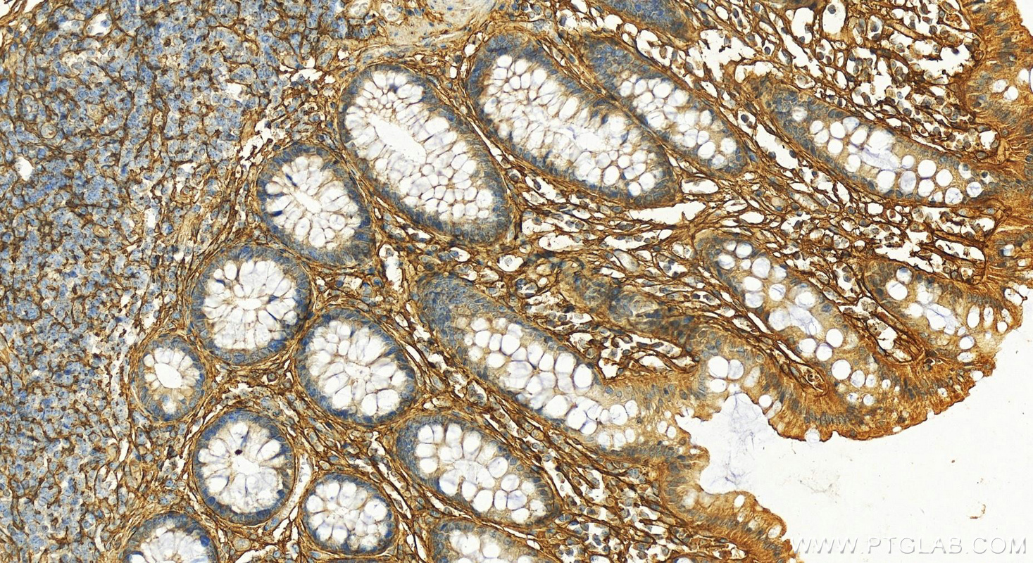 IHC staining of human normal colon using 16922-1-AP