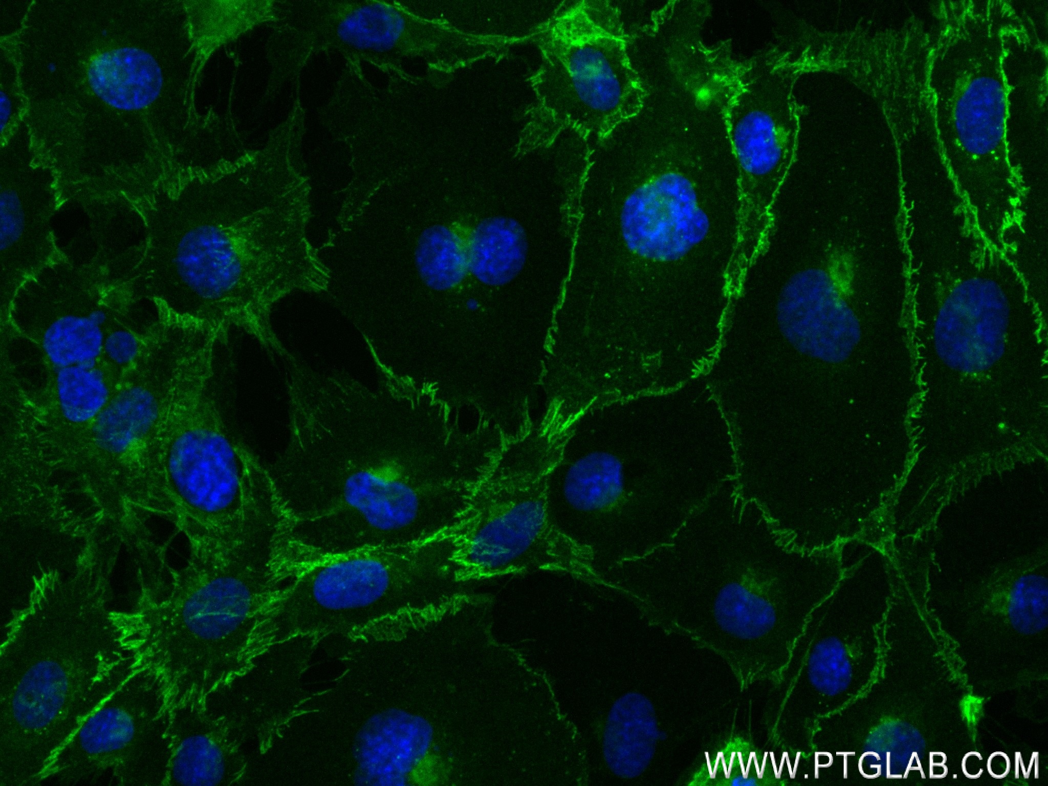 IF Staining of HUVEC using 83766-2-RR