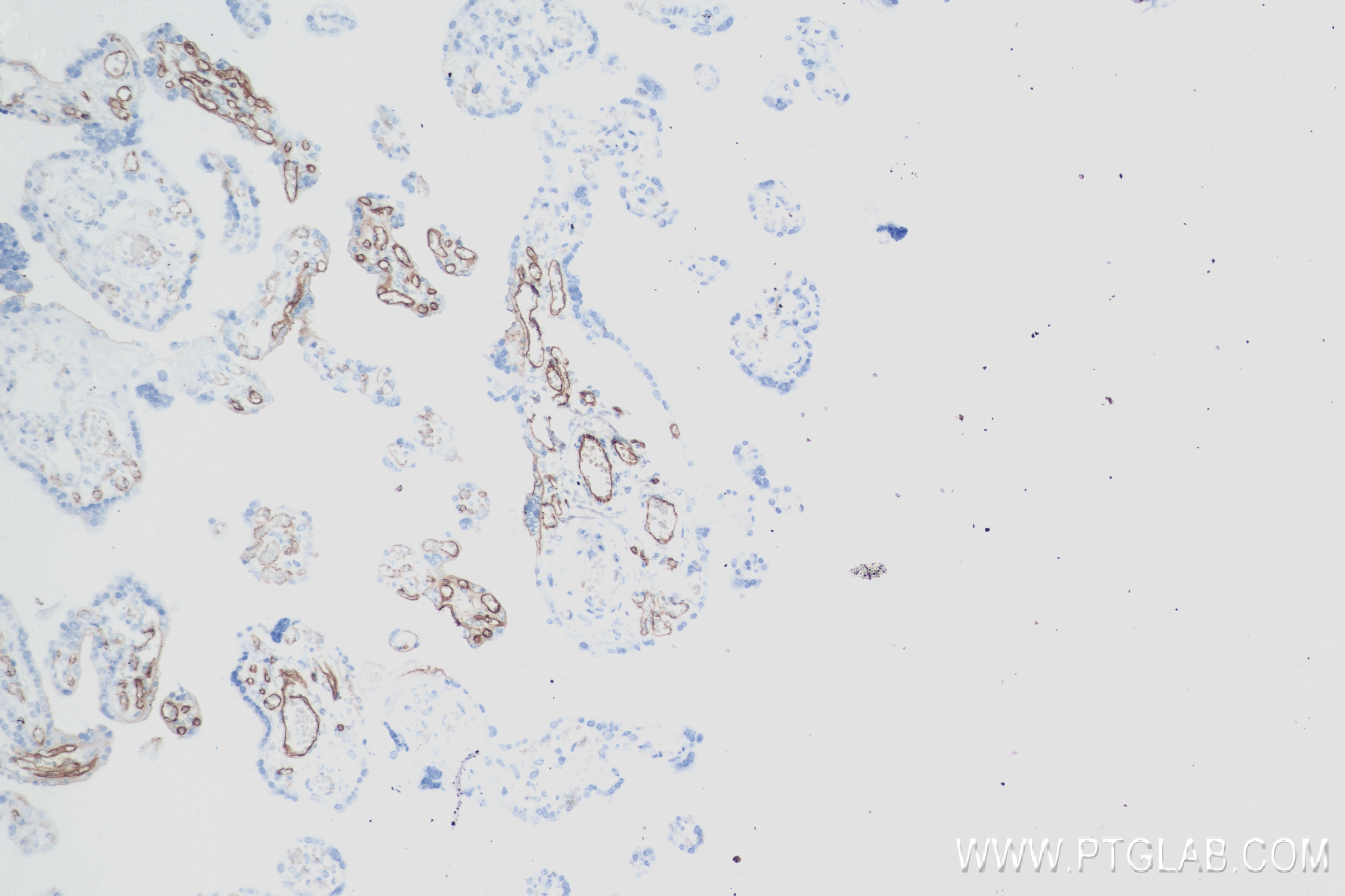 IHC staining of human placenta using 83766-2-RR