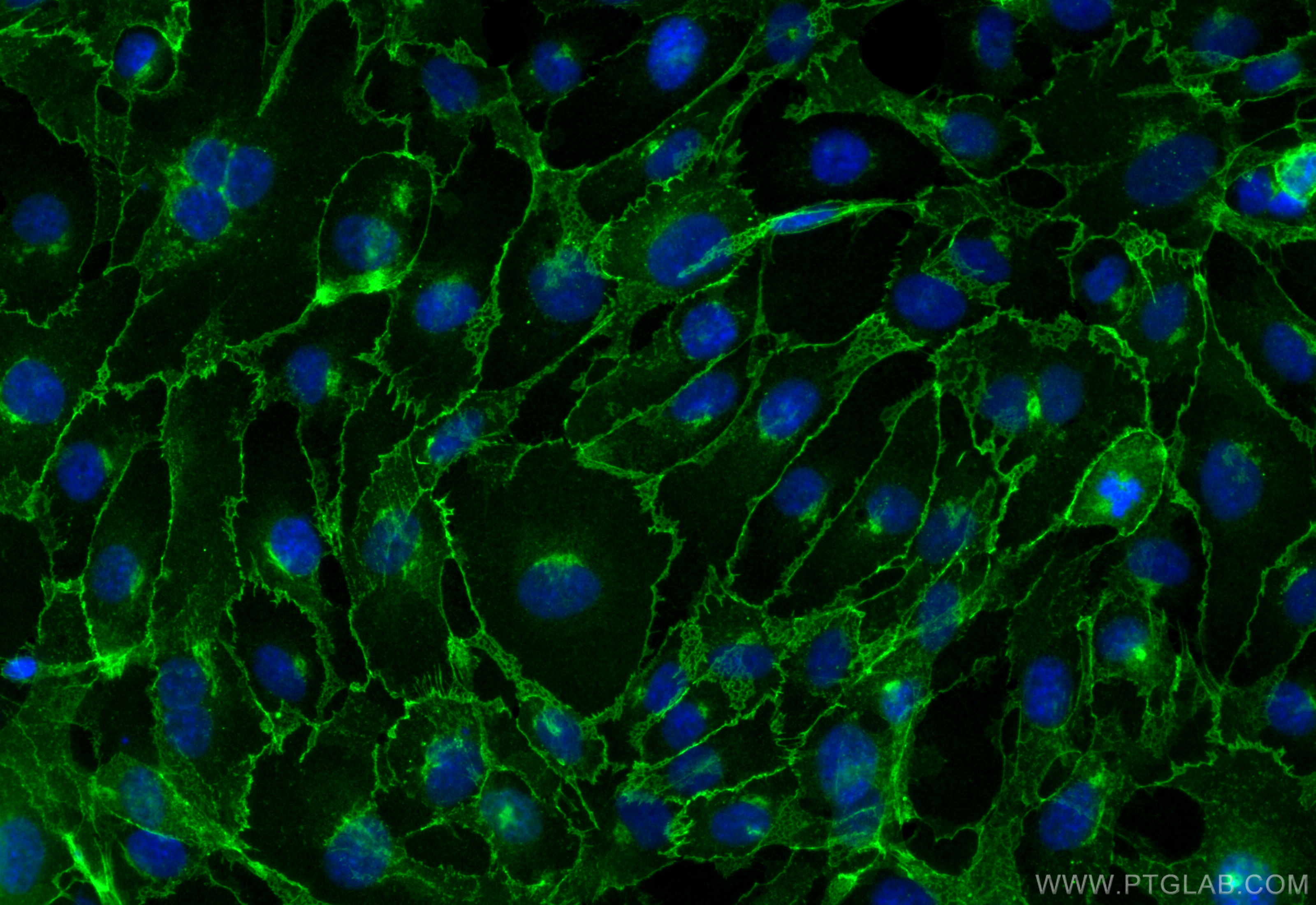 IF Staining of HUVEC using 31772-1-AP