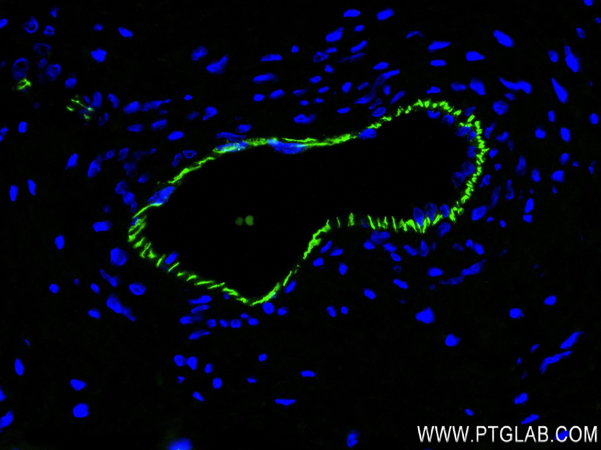 IF Staining of human placenta using 83766-6-RR (same clone as 83766-6-PBS)