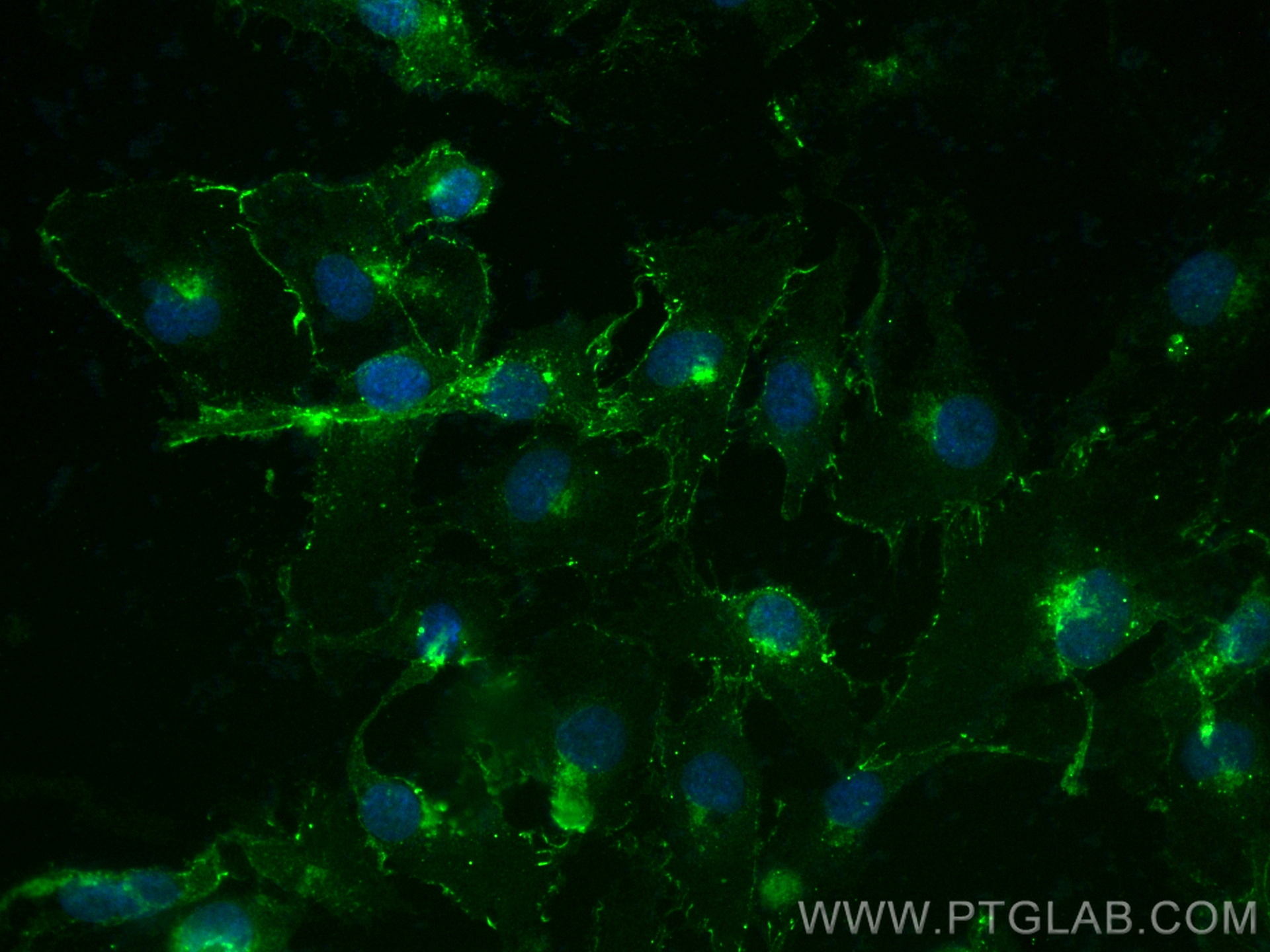 VE-cadherin/CD144