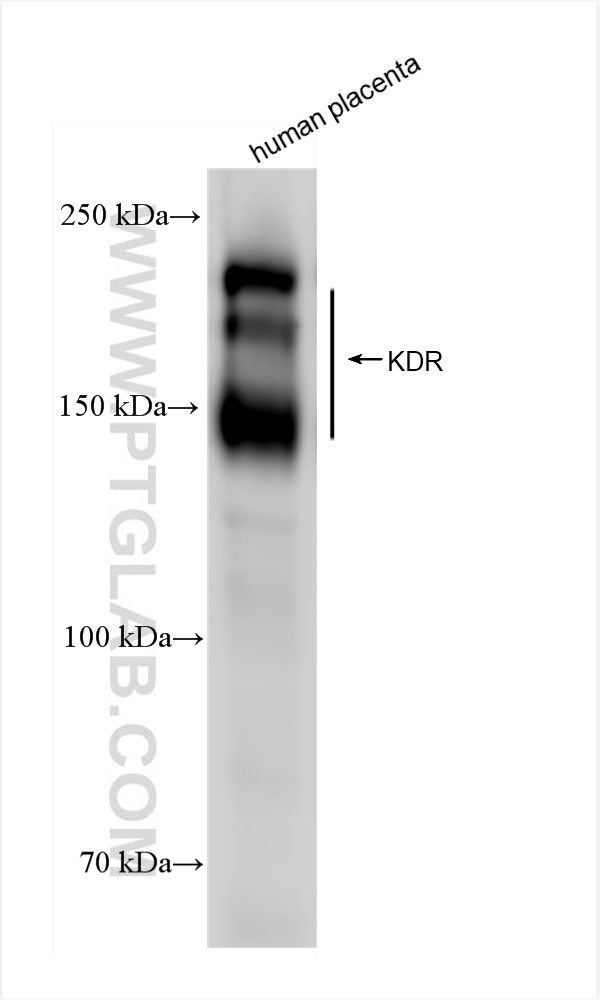 WB analysis of human placenta using 83049-4-RR