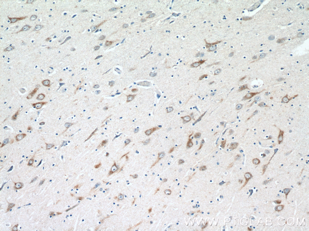 IHC staining of human brain using 26781-1-AP