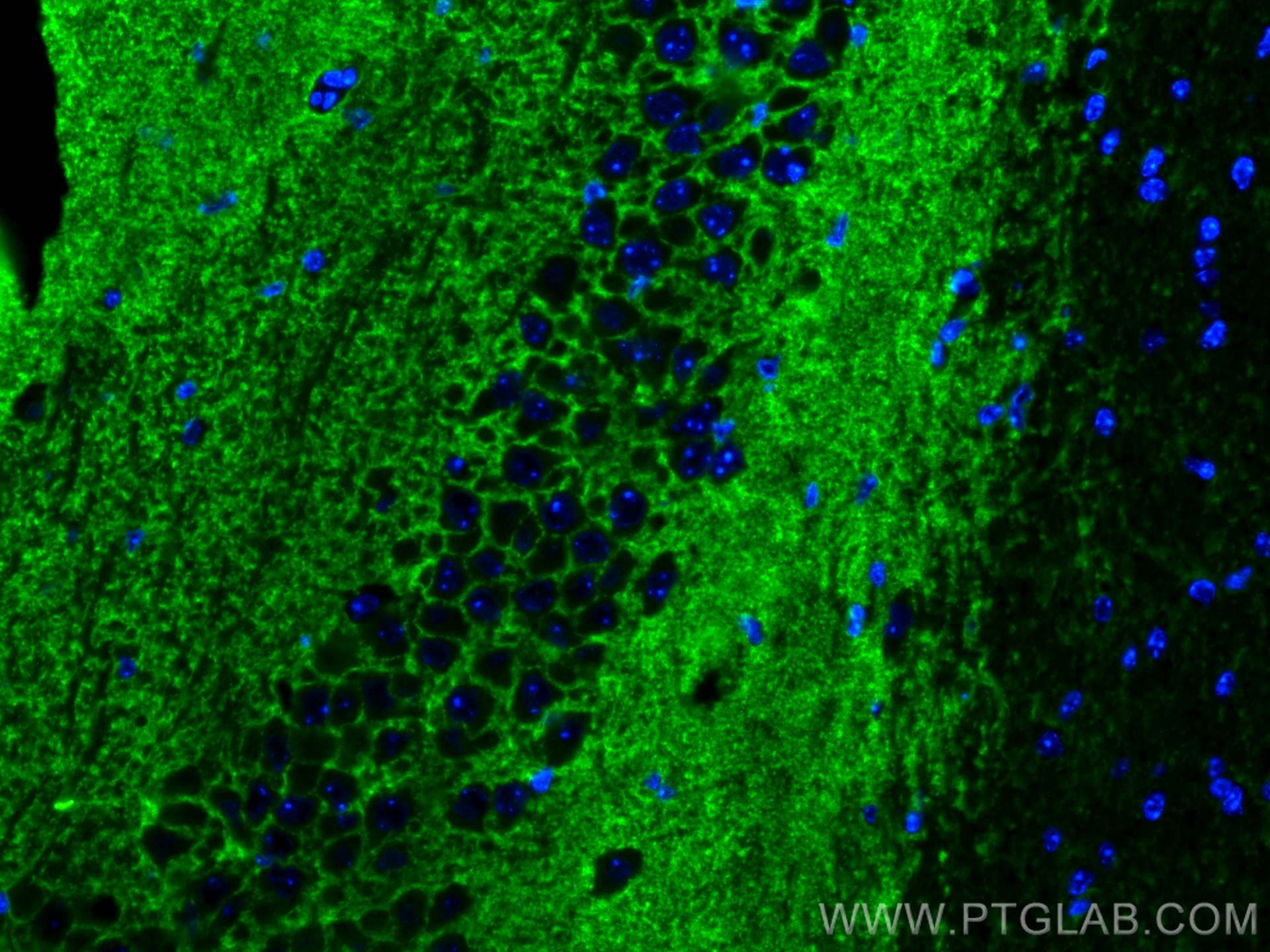 IF Staining of mouse brain using 29209-1-AP