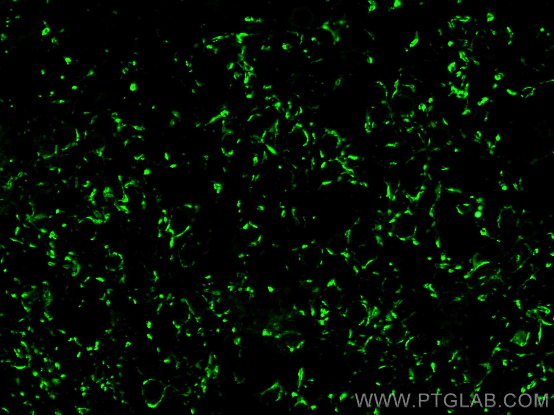 IF Staining of mouse brain using 29209-1-AP