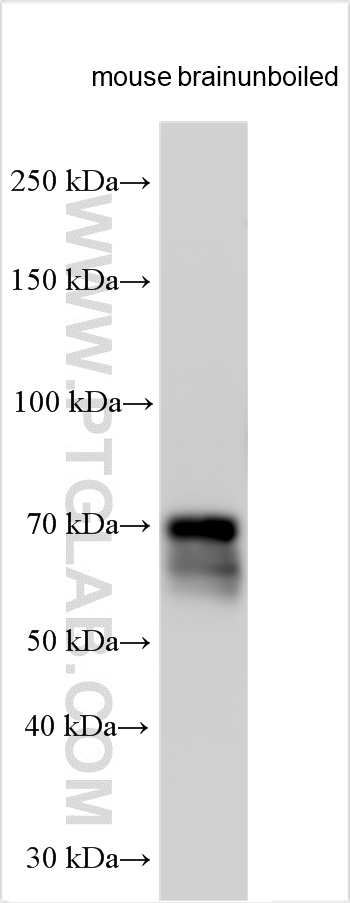 WB analysis using 29209-1-AP