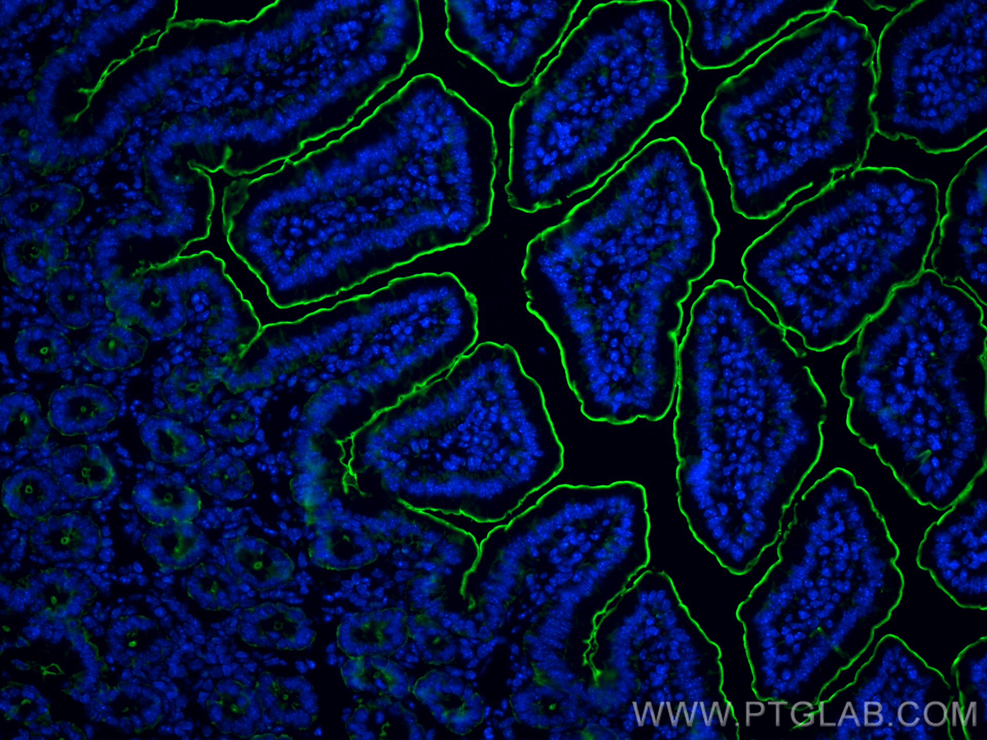 IF Staining of mouse small intestine using 16488-1-AP