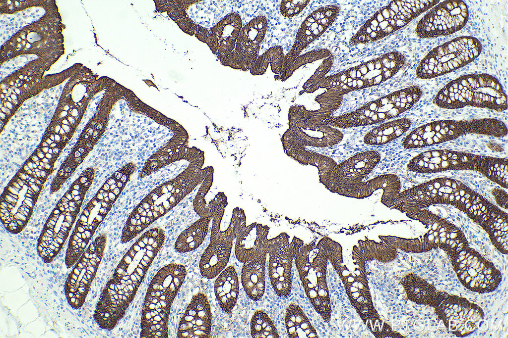 IHC staining of human colon using 66096-1-Ig (same clone as 66096-1-PBS)