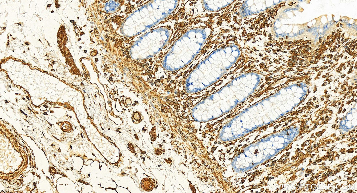 IHC staining of human normal colon using 10366-1-AP