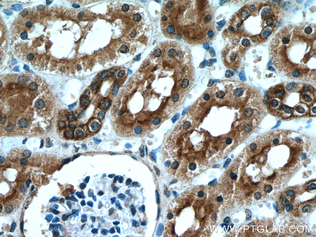 IHC staining of human kidney using 14878-1-AP