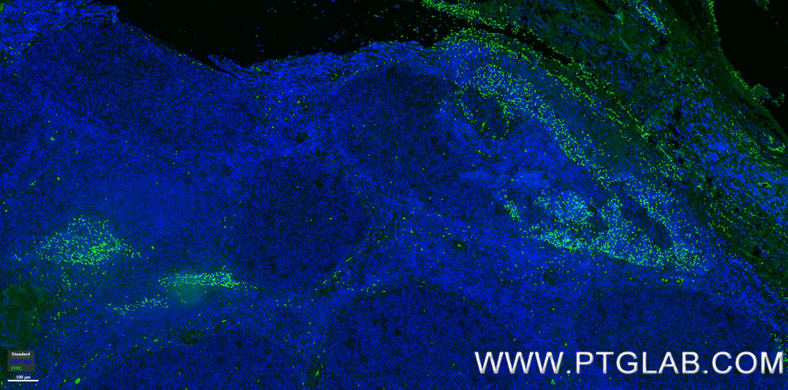 IF Staining of human tonsillitis using 83919-4-RR