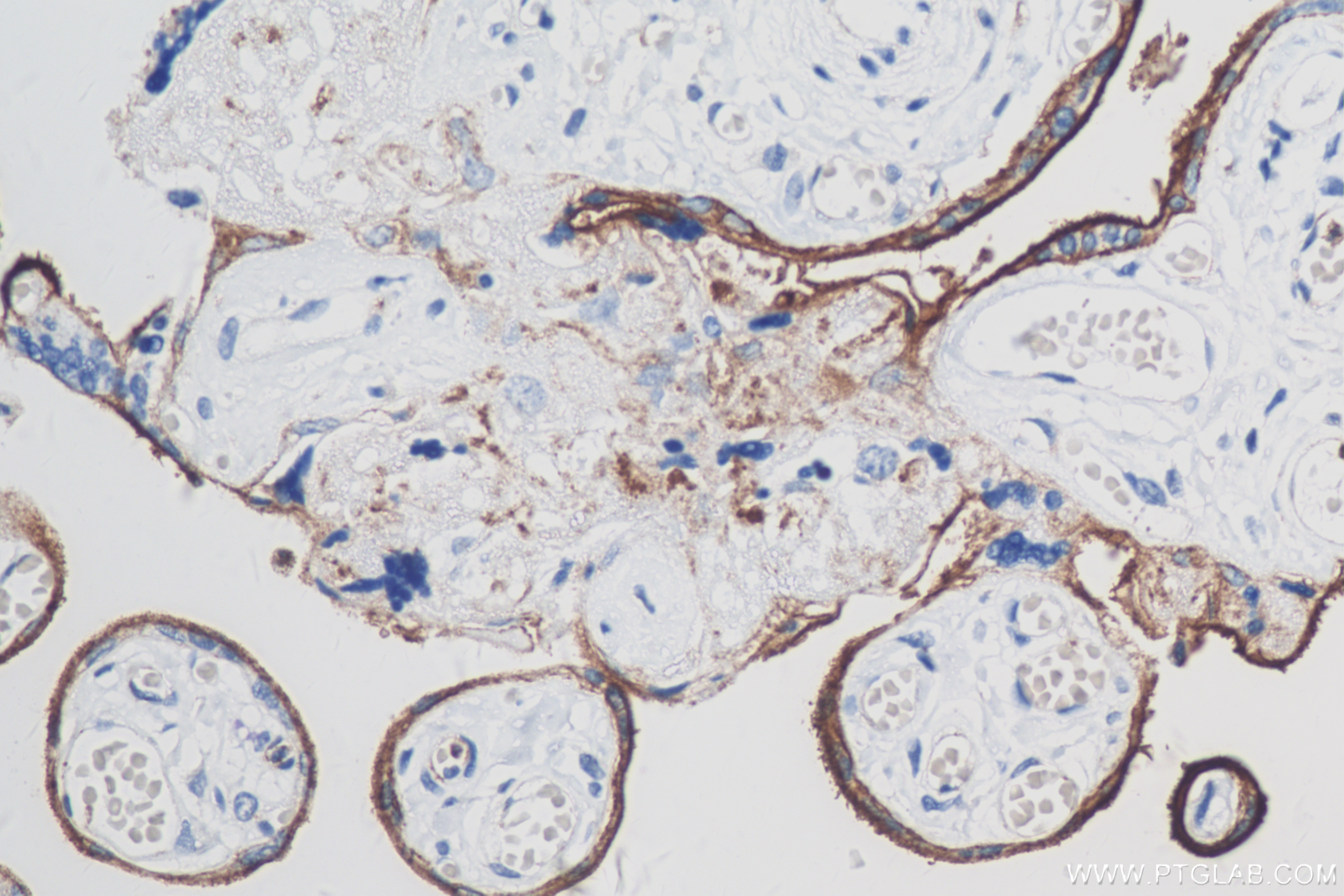 IHC staining of human placenta using 83919-4-RR