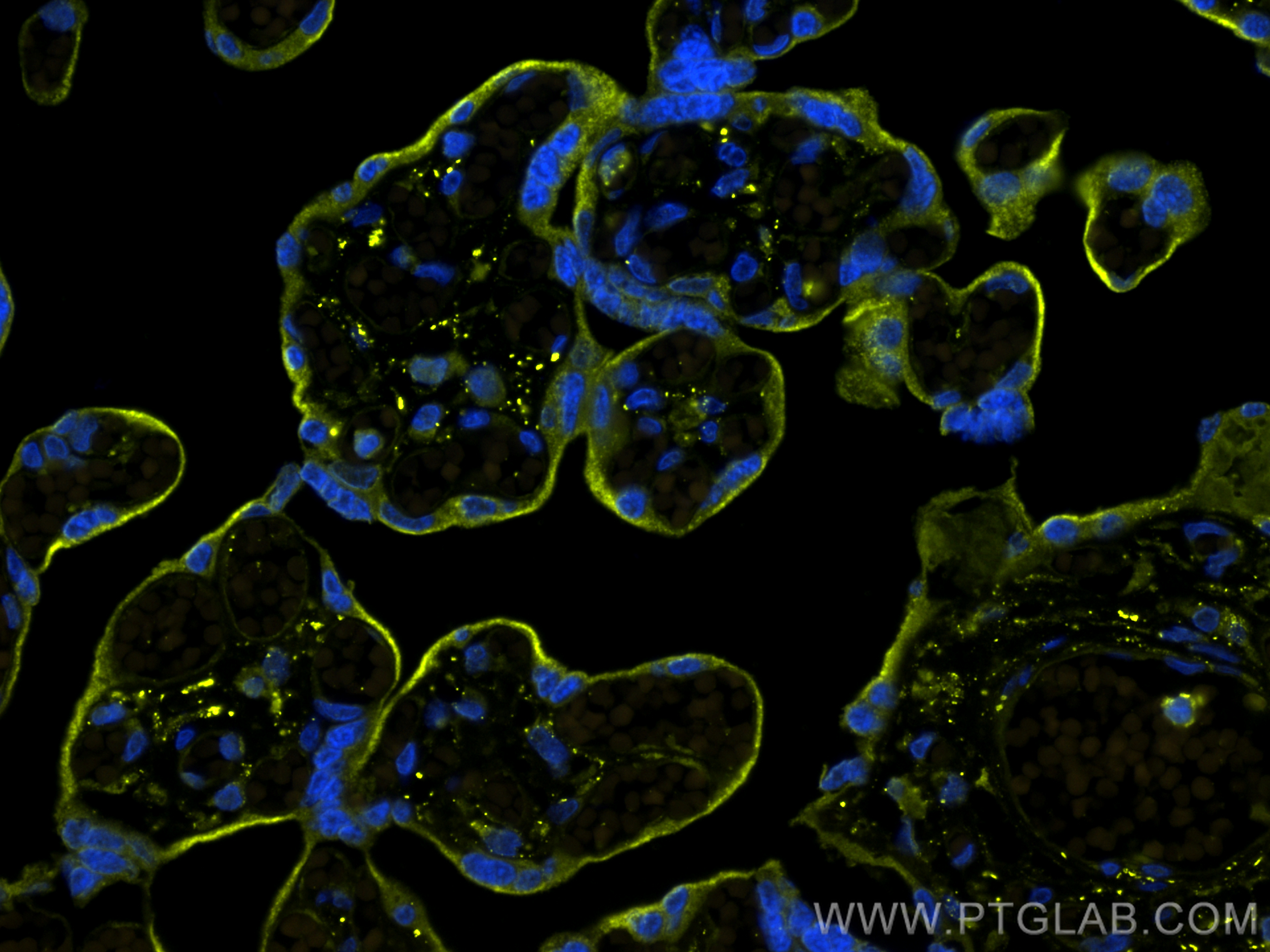 IF Staining of human placenta using CL532-24849